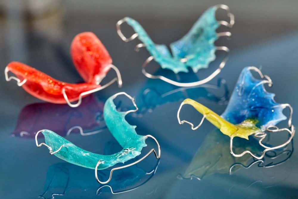 Different types of orthodontic retainers used after braces treatment in Auckland.